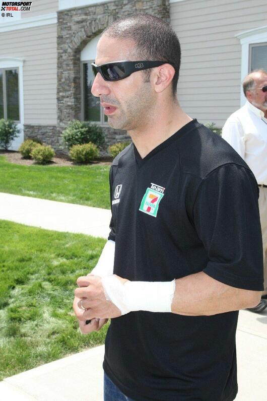  Tony Kanaan mit verletztem Handgelenk