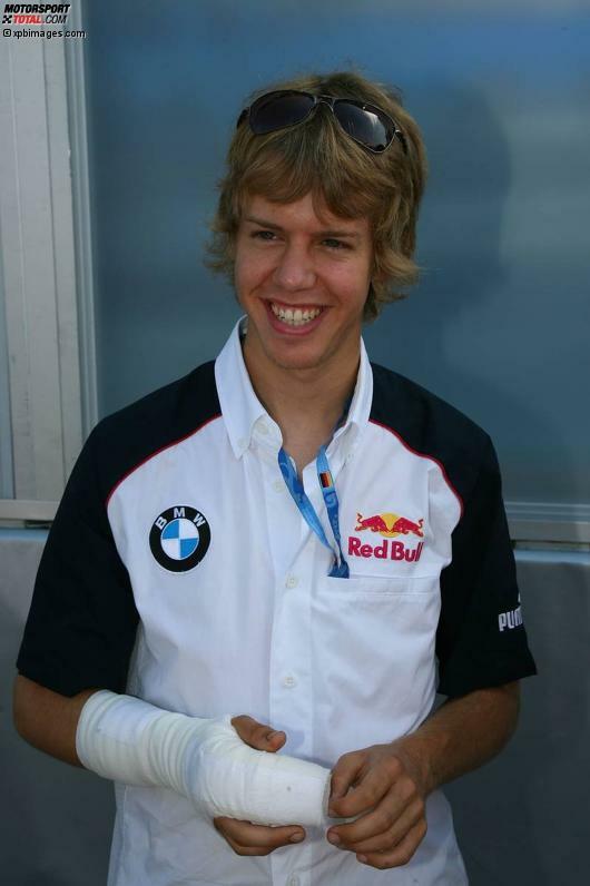 Gebrochener Finger nach einem Rennunfall in der Renault-World-Series in Spa-Francorchamps 2006.