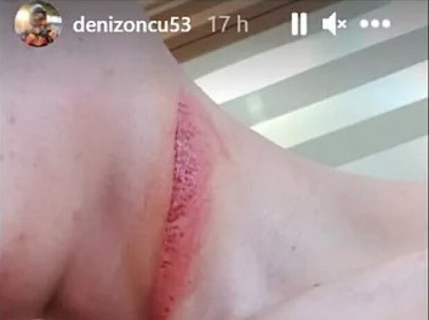 Deniz Öncü Deniz Öncü